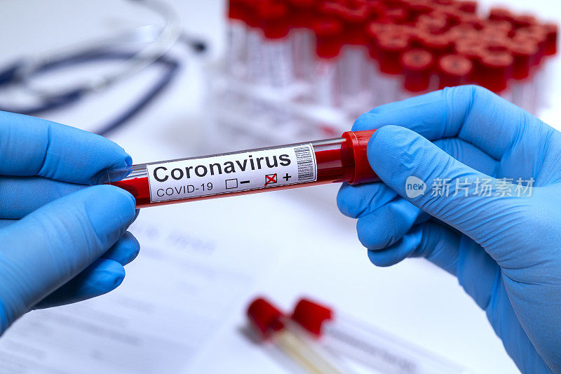 冠状病毒COVID - 19检测新型冠状病毒